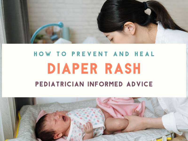 Diaper Rash: Causes, Prevention, and When to Consult a Pediatrician
