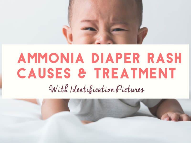Ammonia Diaper Rash: Causes, Treatment & Prevention (with Pictures)