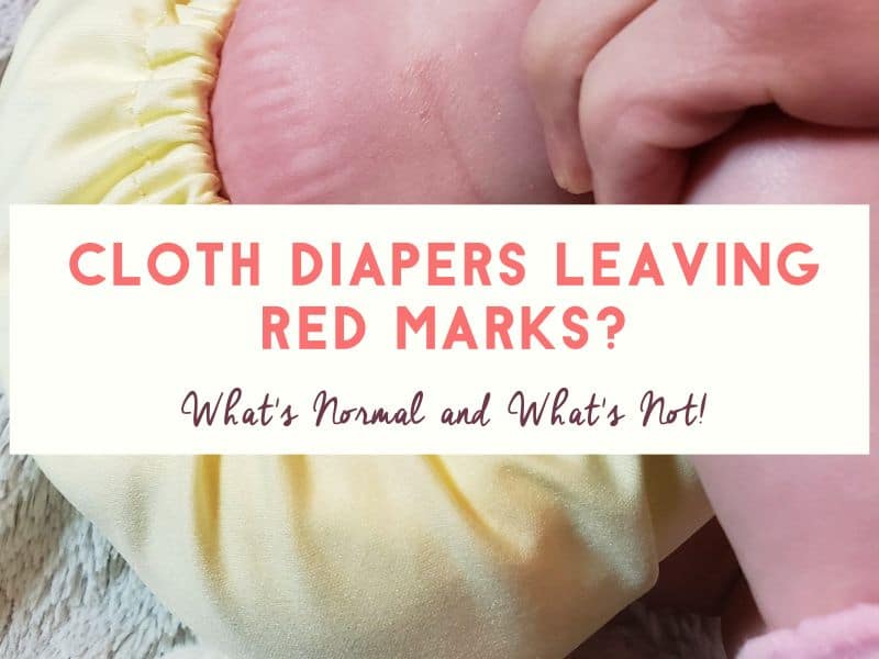 Cloth Diapers Leaving Marks on Your Baby’s Skin? Read This Now!